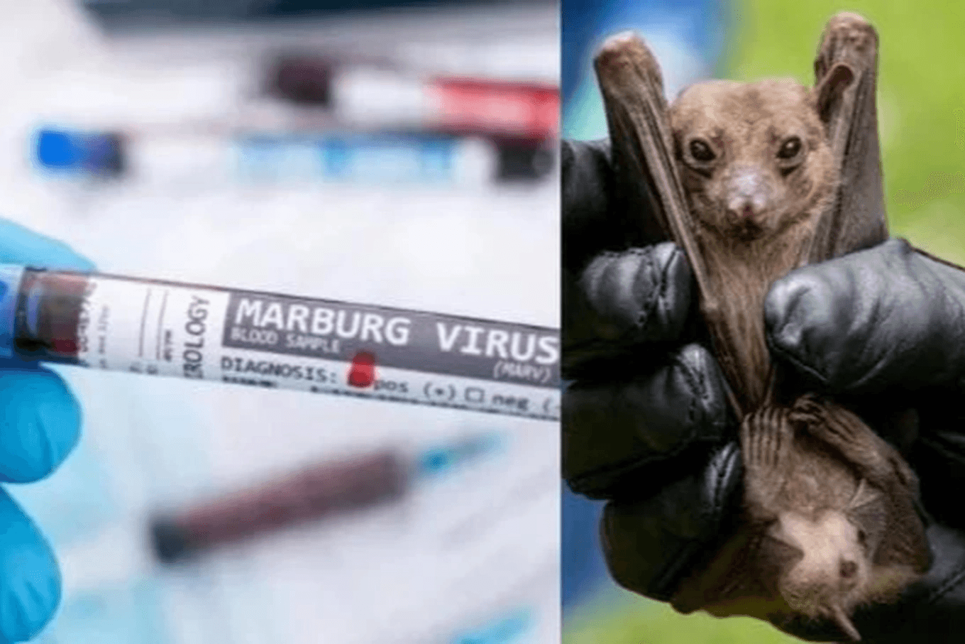 Virus Marburg là gì? Virus Marburg nguy hiểm đến mức nào? Việt Nam có bị ảnh hưởng không?