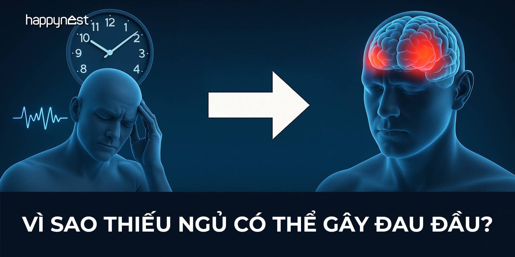 Thiếu ngủ gây đau đầu: Vì sao ngủ không đủ khiến não căng và mỏi mệt cả ngày?