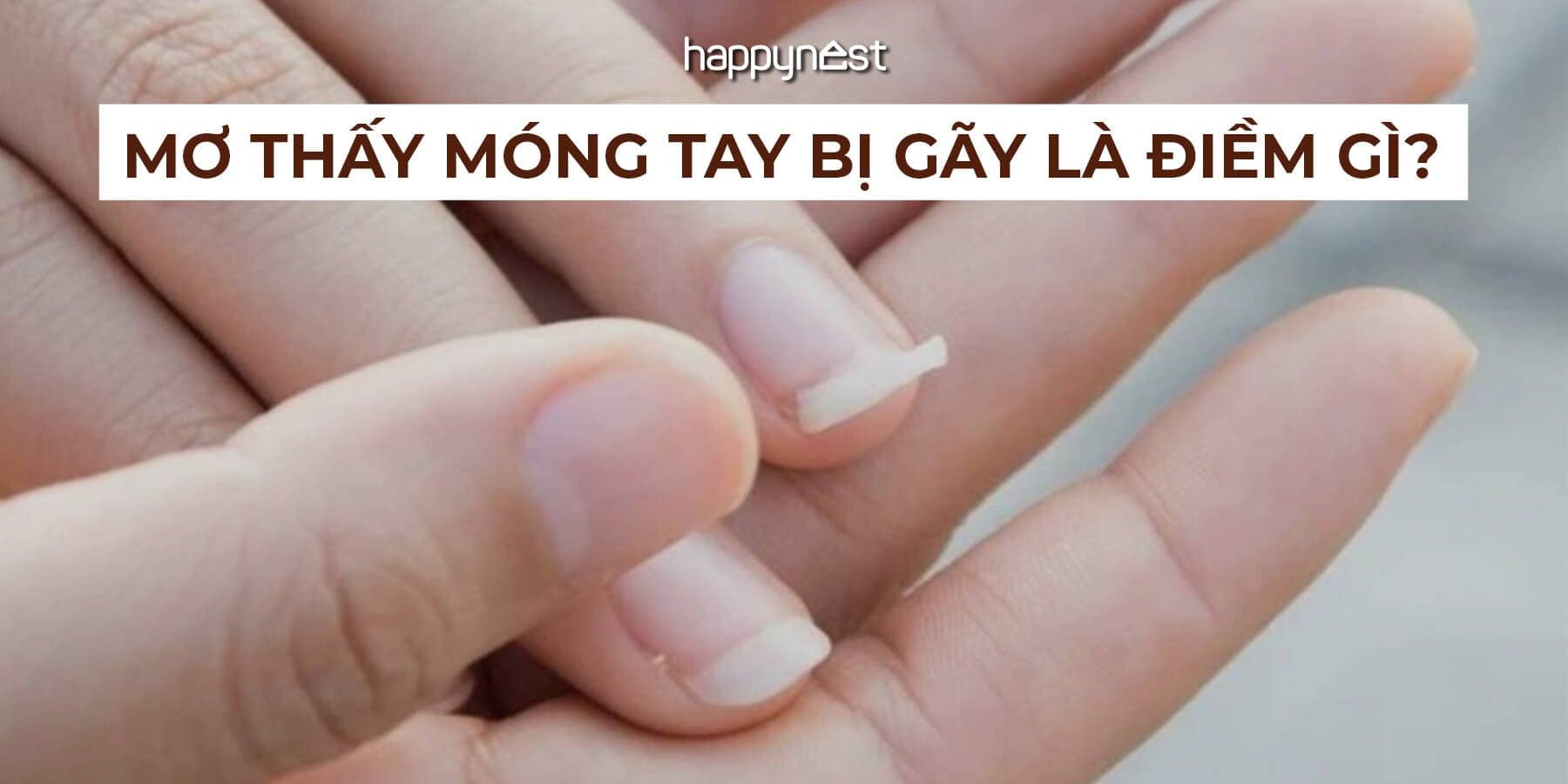 Mơ thấy móng tay bị gãy là điềm gì? May mắn hay cảnh báo điều không tốt?
