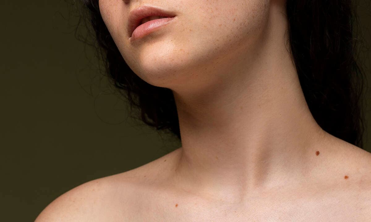 15 vị trí nốt ruồi không nên xóa, đại cát đại lợi, nhất định phải biết